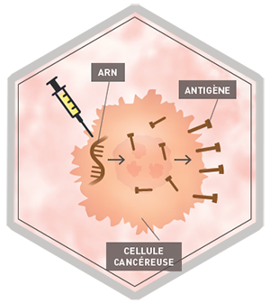 Infographie vaccins thérapeutiques Infographie vaccins thérapeutiques